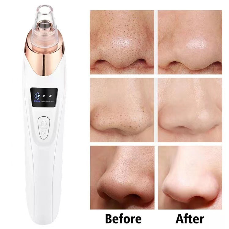 Professional Pore Vacuum | Salon-Quality Blackhead & Pimple Remover