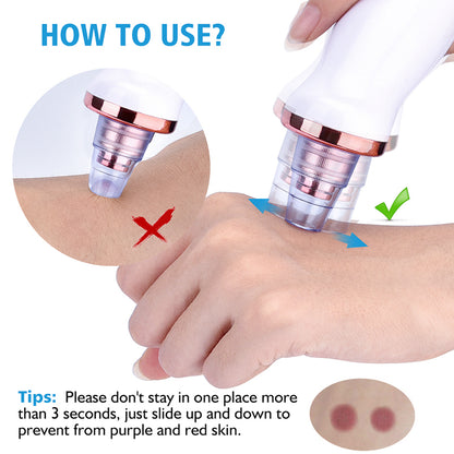 Professional Pore Vacuum & Blackhead Remover | 5-in-1 Facial Treatment